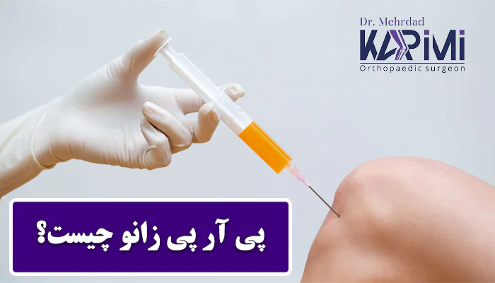 پی آر پی زانو چگونه انجام میشود؟