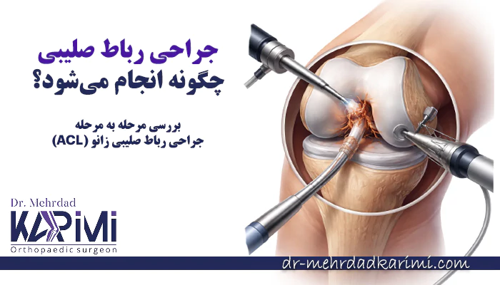 چگونه عمل جراحی رباط صلیبی زانو را انجام میدهند؟