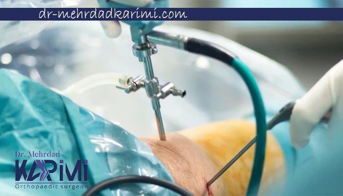 مراحل عمل رباط صلیبی زانو چیست؟