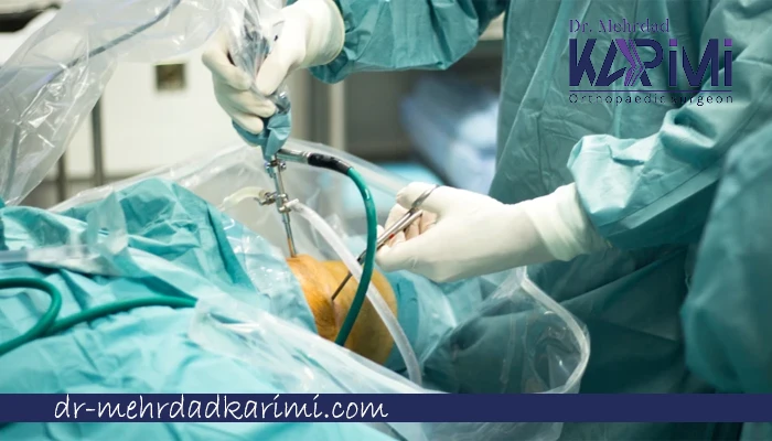 چه کسانی باید رباط صلیبی خود را عمل کنند؟