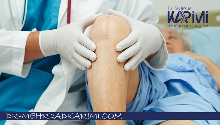 بهترین دکتر تعویض مفصل زانو چه ویژگی هایی دارد؟
