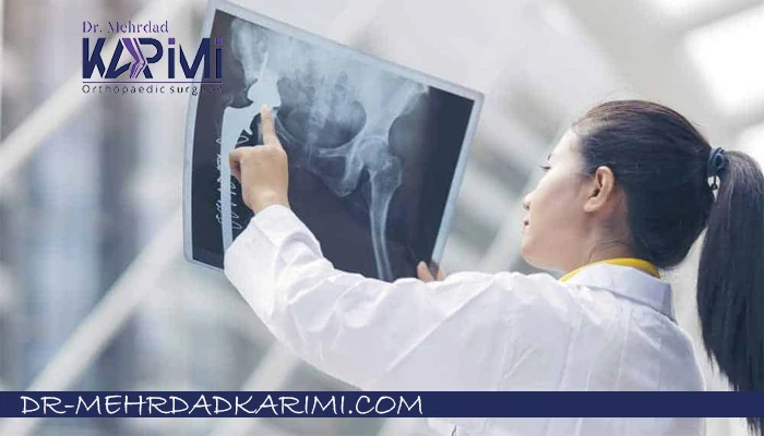 روش های پیشگیری از شکستگی لگن