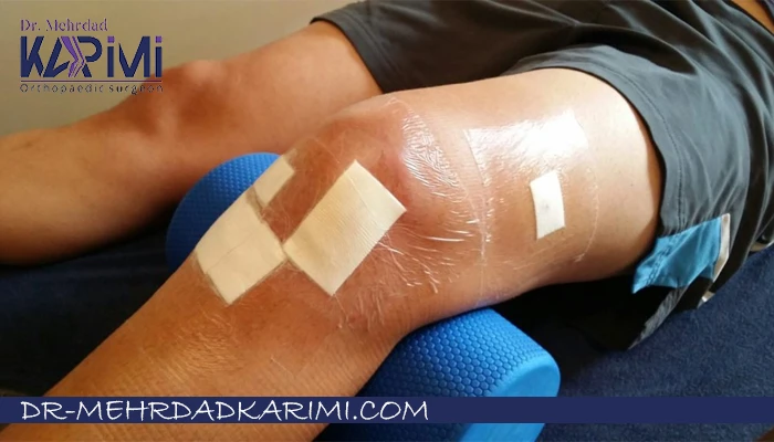 علائم خطر بعد از عمل رباط صلیبی که باید جدی بگیرید