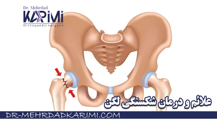 علائم و درمان شکستگی لگن