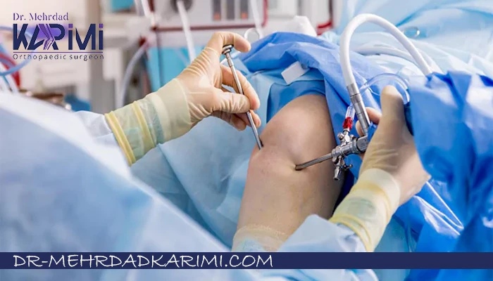 عوامل موثر در هزینه عمل رباط صلیبی زانو چیست؟
