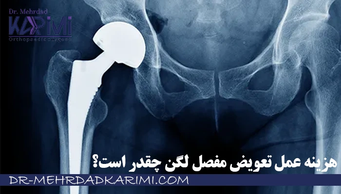 هزینه عمل تعویض مفصل لگن چقدر است؟