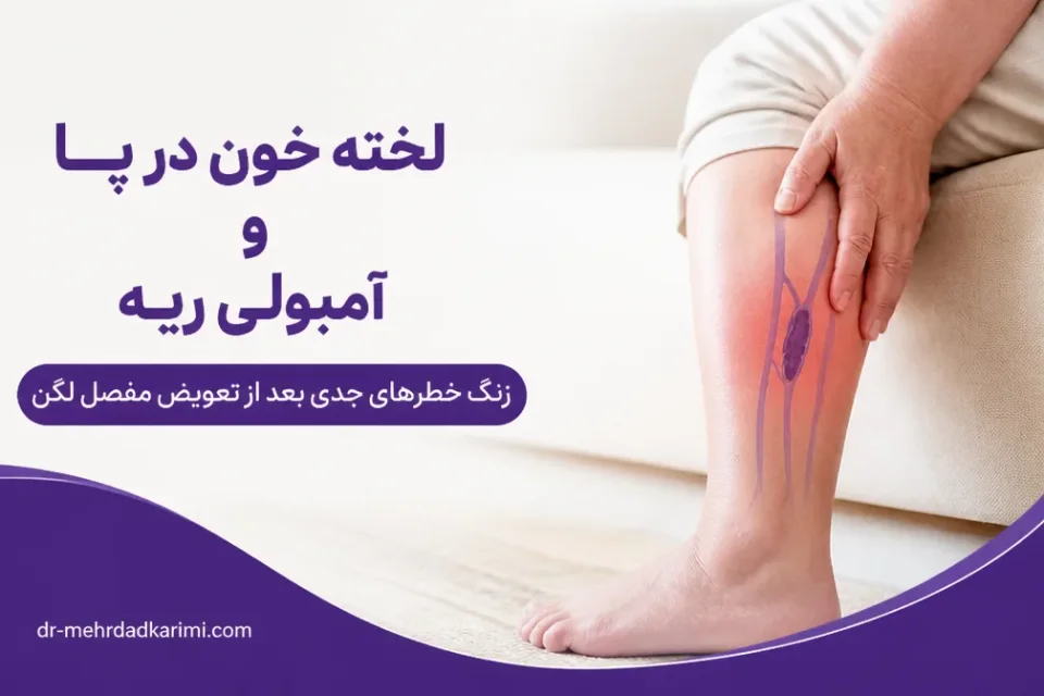 لخته خون در پا و آمبولی ریه — تصویر آموزشی نشانههای لخته خون در ساق پا پس از تعویض مفصل لگن