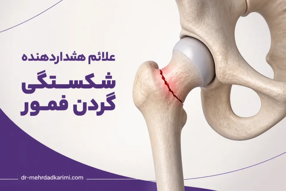 علائم هشداردهنده شکستگی گردن فمور — نمای شماتیک محل شکستگی گردن فمور در مفصل ران
