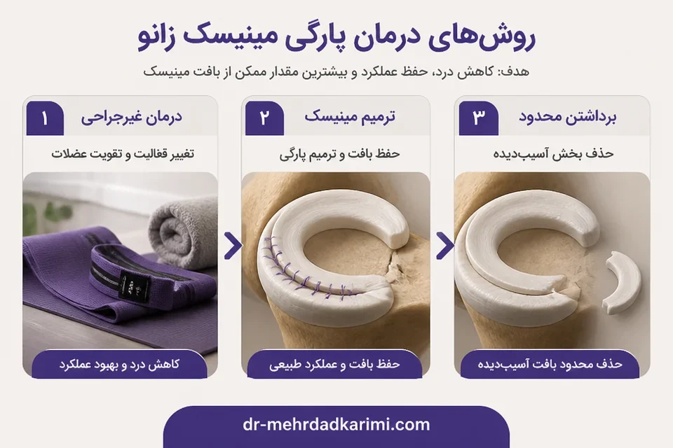 مسیر انتخاب درمان غیرجراحی یا جراحی مینیسک