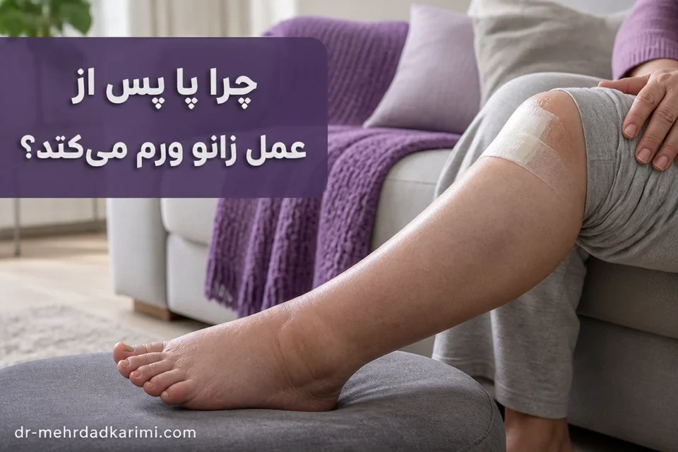 تورم خفیف ساق و مچ پس از جراحی زانو